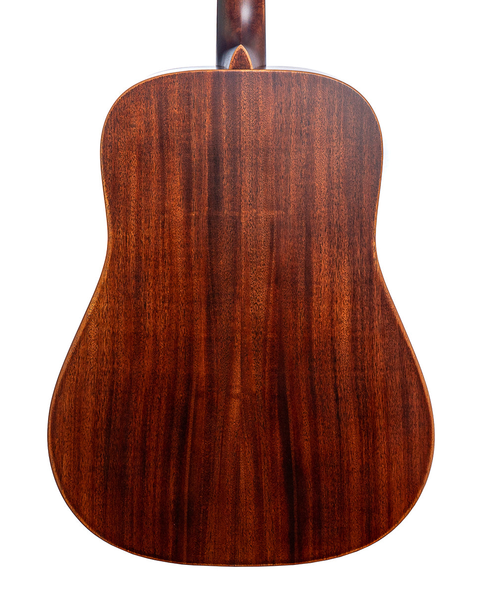 Martin D-15E StreetMaster